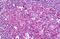 Ubiquilin 1 antibody, MBS244647, MyBioSource, Immunohistochemistry paraffin image 