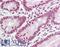 Heterogeneous Nuclear Ribonucleoprotein L antibody, LS-B7671, Lifespan Biosciences, Immunohistochemistry paraffin image 