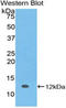 S100 Calcium Binding Protein A5 antibody, LS-C302891, Lifespan Biosciences, Western Blot image 