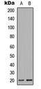 Mitochondrial Ribosomal Protein L51 antibody, LS-C358808, Lifespan Biosciences, Western Blot image 