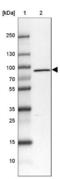 LZTS2 antibody, NBP1-82892, Novus Biologicals, Western Blot image 