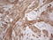 Spermatogenesis Associated 22 antibody, LS-C791627, Lifespan Biosciences, Immunohistochemistry paraffin image 