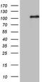 Microcephalin 1 antibody, LS-C790421, Lifespan Biosciences, Western Blot image 