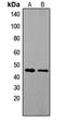 Tachykinin Receptor 1 antibody, LS-C358357, Lifespan Biosciences, Western Blot image 