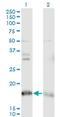 NADH dehydrogenase [ubiquinone] 1 alpha subcomplex subunit 8 antibody, H00004702-M05, Novus Biologicals, Western Blot image 