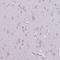 Actin Related Protein T3 antibody, HPA035817, Atlas Antibodies, Immunohistochemistry paraffin image 