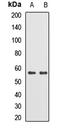 TRNA Methyltransferase 2 Homolog B antibody, LS-C668566, Lifespan Biosciences, Western Blot image 