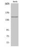 Inositol Polyphosphate-5-Phosphatase D antibody, STJ95655, St John