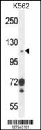 Integrin Subunit Alpha E antibody, 55-218, ProSci, Western Blot image 