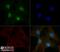 Tumor Protein P53 Binding Protein 1 antibody, NBP2-54753, Novus Biologicals, Immunocytochemistry image 
