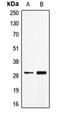 CD70 Molecule antibody, LS-C351958, Lifespan Biosciences, Western Blot image 