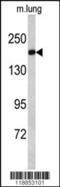 Alsin Rho Guanine Nucleotide Exchange Factor ALS2 antibody, 62-280, ProSci, Western Blot image 