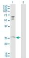 Myosin IIIA antibody, H00053904-D01P, Novus Biologicals, Western Blot image 