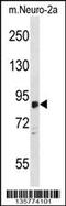 Zinc Finger DHHC-Type Containing 8 antibody, 58-712, ProSci, Western Blot image 