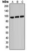 ATP Binding Cassette Subfamily B Member 7 antibody, LS-B13035, Lifespan Biosciences, Western Blot image 