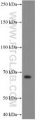 Chromogranin A antibody, 60135-1-Ig, Proteintech Group, Western Blot image 