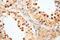 Glycerol-3-Phosphate Dehydrogenase 2 antibody, 17219-1-AP, Proteintech Group, Immunohistochemistry paraffin image 