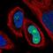 Protein SSX2 antibody, HPA045683, Atlas Antibodies, Immunofluorescence image 