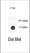 Interleukin 6 Signal Transducer antibody, abx032064, Abbexa, Dot Blot image 