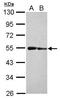 ST3 Beta-Galactoside Alpha-2,3-Sialyltransferase 3 antibody, PA5-31626, Invitrogen Antibodies, Western Blot image 