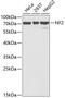 Neurofibromin 2 antibody, GTX54576, GeneTex, Western Blot image 