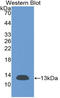 Beta-2-Microglobulin antibody, LS-C314174, Lifespan Biosciences, Western Blot image 