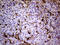 Transglutaminase 2 antibody, LS-C791941, Lifespan Biosciences, Immunohistochemistry paraffin image 