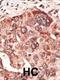 Recoverin antibody, 58-189, ProSci, Immunohistochemistry paraffin image 