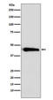 Argininosuccinate Synthase 1 antibody, M02212-3, Boster Biological Technology, Western Blot image 