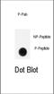 GIT ArfGAP 1 antibody, abx032028, Abbexa, Western Blot image 