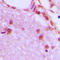 Heterogeneous Nuclear Ribonucleoprotein H1 antibody, LS-C352300, Lifespan Biosciences, Immunohistochemistry paraffin image 