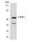 Vasoactive Intestinal Peptide Receptor 1 antibody, LS-C200815, Lifespan Biosciences, Western Blot image 