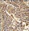 Junction Plakoglobin antibody, PA5-35375, Invitrogen Antibodies, Immunohistochemistry paraffin image 