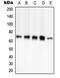 P21 (RAC1) Activated Kinase 3 antibody, MBS820209, MyBioSource, Western Blot image 