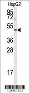 Aurora Kinase B antibody, MBS9207385, MyBioSource, Western Blot image 