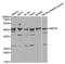 SMYD Family Member 5 antibody, STJ27952, St John