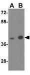 Adenosine A2b Receptor antibody, GTX31945, GeneTex, Western Blot image 