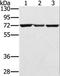 Solute Carrier Family 25 Member 13 antibody, LS-C402028, Lifespan Biosciences, Western Blot image 