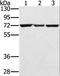 Citrin antibody, LS-C402028, Lifespan Biosciences, Western Blot image 