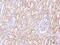 DAZ Interacting Zinc Finger Protein 3 antibody, 202556-T08, Sino Biological, Immunohistochemistry paraffin image 