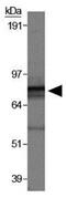 Sperm Antigen With Calponin Homology And Coiled-Coil Domains 1 antibody, GTX30652, GeneTex, Western Blot image 