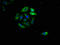 FAS antibody, LS-C211648, Lifespan Biosciences, Immunofluorescence image 