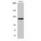Protein Tyrosine Kinase 2 antibody, LS-C383456, Lifespan Biosciences, Western Blot image 