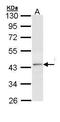 Thyroid Hormone Receptor Beta antibody, GTX113278, GeneTex, Western Blot image 