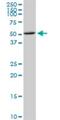 CDP-Diacylglycerol Synthase 1 antibody, H00001040-M01, Novus Biologicals, Western Blot image 