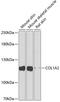 Collagen Type I Alpha 2 Chain antibody, GTX64468, GeneTex, Western Blot image 