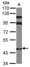 Zinc Finger Protein 384 antibody, LS-C155189, Lifespan Biosciences, Western Blot image 
