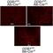 Epithelial Cell Adhesion Molecule antibody, ab32392, Abcam, Immunohistochemistry paraffin image 