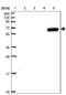 Zinc Finger Protein 555 antibody, NBP2-49106, Novus Biologicals, Western Blot image 