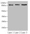 Signal Transducer And Activator Of Transcription 5B antibody, LS-C376711, Lifespan Biosciences, Western Blot image 
